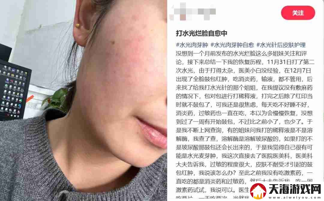 扎堆修复